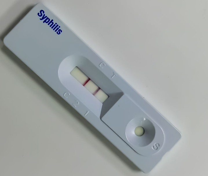 Sifilis antigeno azkarreko proba